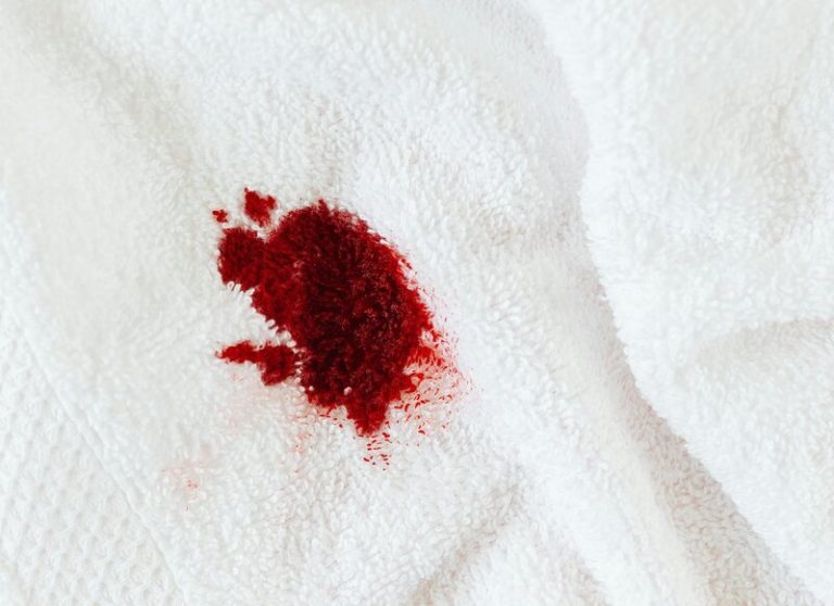 how to get dried blood out of carpet baking soda